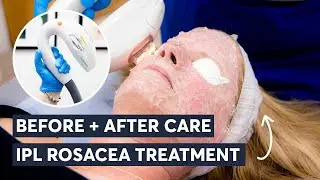IPL Treatment Care (Before And After)