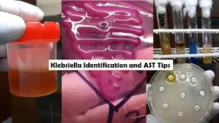 ESBL Producer, XDR  Strain Klebsiella pneumoniae isolation from Urine Culture and Sensitivity