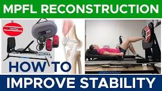 Medial Patellofemoral Ligament Reconstruction | Improving Stability | Part 1