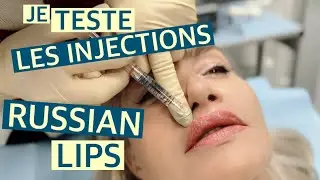 JE TESTE LES INJECTIONS RUSSIAN LIPS EN LIVE !