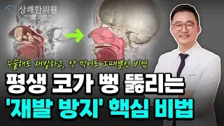 평생 재발없는 알레르기 비염 치료법 '면역관용'의 비밀