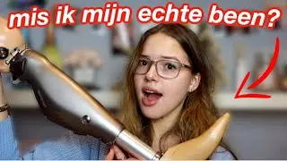 HOE loop IK met een NEP BEEN?*prothesebeen Q&A*