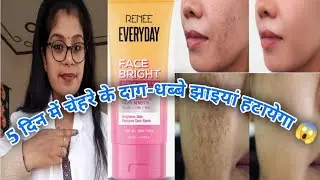 Renee Everyday Face Brightening Cream Review | Renee Everyday Face Bright Serum Cream Review Hindi |