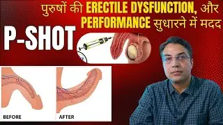 P-Shot - पुरुषों की erectile dysfunction, performance और sensitivity को सुधारने में मदद | जानिए कैसे