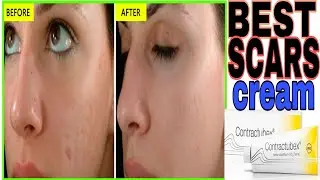 Best Scar Treatment | Best Cream to remove scars | 100% results.