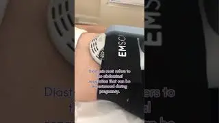 У вас диастаз прямых мышц живота? Узнайте, как EMSculpt NEO может помочь | Косметическая клиника ...