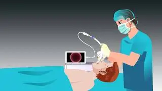 Safe-Cam -- disposable Video Stylet -- Explainer Video