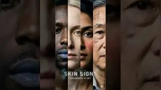 Doctors Read Disease From Skin&mdash;Do You?