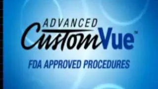 Advanced CustomVue