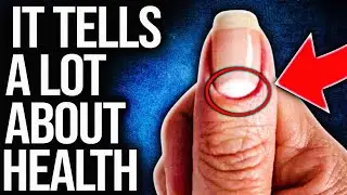 14 Things The Moon On Your Nails Says About Your Health