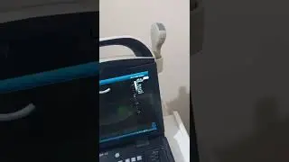 تعلم سونار العيادة ١