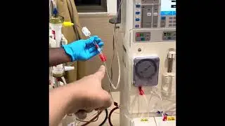 Double Filtration Plasmapheresis (DFPP) Circuit Setup | DFPP Before Kidney Transplant