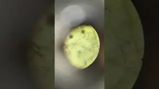 Potato Fungal infection through Microscope #rrrterracegarden#fungalinfection#potato#Microscope