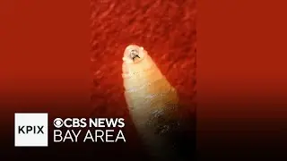 First human case of New World Screwworm parasite in U.S. confirmed