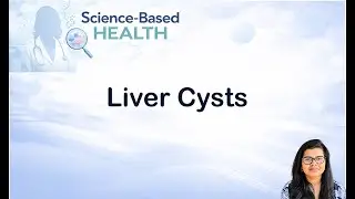 Understanding Liver cysts