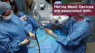Hernia Surgery Lawsuit Information