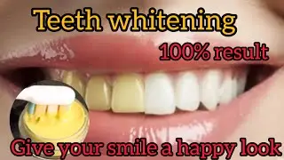 Natural teeth whitening at home| yellow teeth solution | peele dant kaise saaf karen