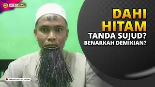Dahi Hitam Tanda Sujud? Benarkah demikian?
