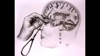 Enforcement lobotomy