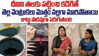 ఎన్ని తెల్ల వెంట్రుకలు ఉన్నా మొత్తం నల్లబడతాయి..| White Hair to Black Hair | Shobha Rani | Hair Fall