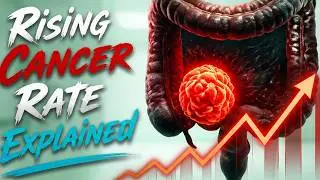 Why Colorectal Cancer is Rising in Young Adults | Alarming Statistics & What You Need to Know