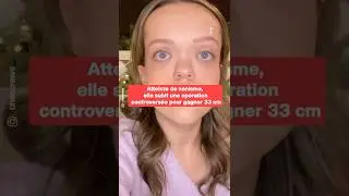 Atteinte de nanisme, elle subit une op&eacute;ration controvers&eacute;e pour gagner 33 cm