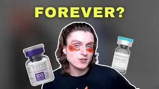 Why People Hate Botox (My Honest Rant)