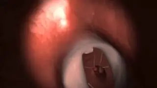 heart fly through - 3D medical animation