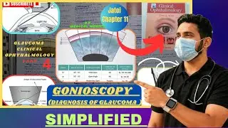 Glaucoma | Gonioscopy | Jatoi Clinical Ophthalmology | Chapter 11 Part 4
