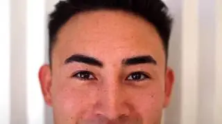 Ashley's personal Botox story