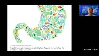 The Mind-Gut Conversation [Free webinar]