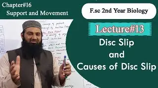 Biology Ch#16-Lecture#13  Disc slip and causes of disk slip (F.Sc 2nd Year)