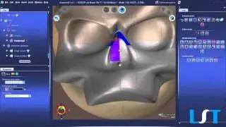 3Shaper Smiling Skull