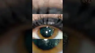 Hialosis ASTEROIDEA
