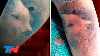 ¡ALERTA: TATUAJES! Una bacteria, una infección... ¡y mucha preocupación!