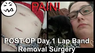 Post-op Day 1 Lap band Removal Surgery LOTS OF PAIN