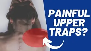 Upper Trap Pain Help (Step by Step)