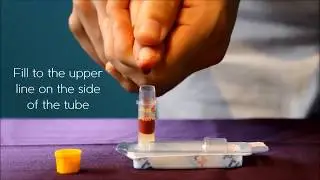 Step by step guide to take own bloods MESMAC