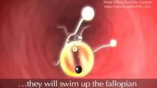 Follicle Development and Ovulation I Educational Video I Planet WOMEN IVF Centre I Dr.Mehul Damani