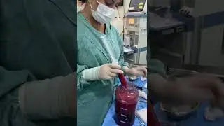 Enxerto de gordura para o gl&uacute;teo.