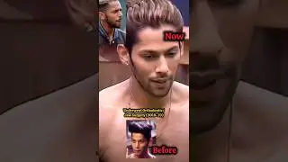 Baseer ali smile makeover #baseerali #bigboss19 #smile