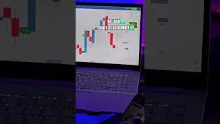 Start Trading Journey is Easy Target in 2025 |Subscribe #trendingshorts #trading #tradingjourney