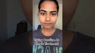 Trying boroline for pimple #boroline #pimpletreatment #shortsfeed #shorts #trending #ytshorts