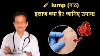 Injection Ke Baad Ganth Kyu Hoti Hai? Homeopathy Se Ilaj | Dr Varun Kumar