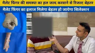 मैलेट फिंगर की समस्या का हल जल्द करवाने से रिजल्ट बेहतर और जल्दी | Mallet Finger Treatment