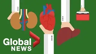 Why Canada struggles to perform just 600 organ donations per year