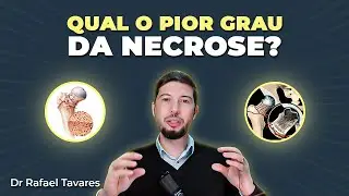 Qual é o pior Grau da Necrose da Cabeça do Fêmur? | Dr Rafael Tavares - Quadril