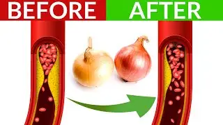 16 Foods That Can Clean Your Arteries and May Prevent a Heart Attack