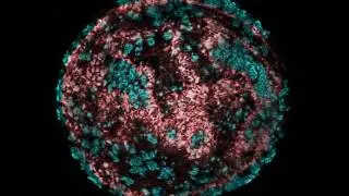 Trial to Reverse Deafness To Begin in 2019 - Frequency Therapeutics