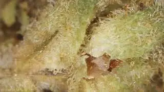 BNM Papaya Bantz Big Narstie Medical Close Up Microscope View
